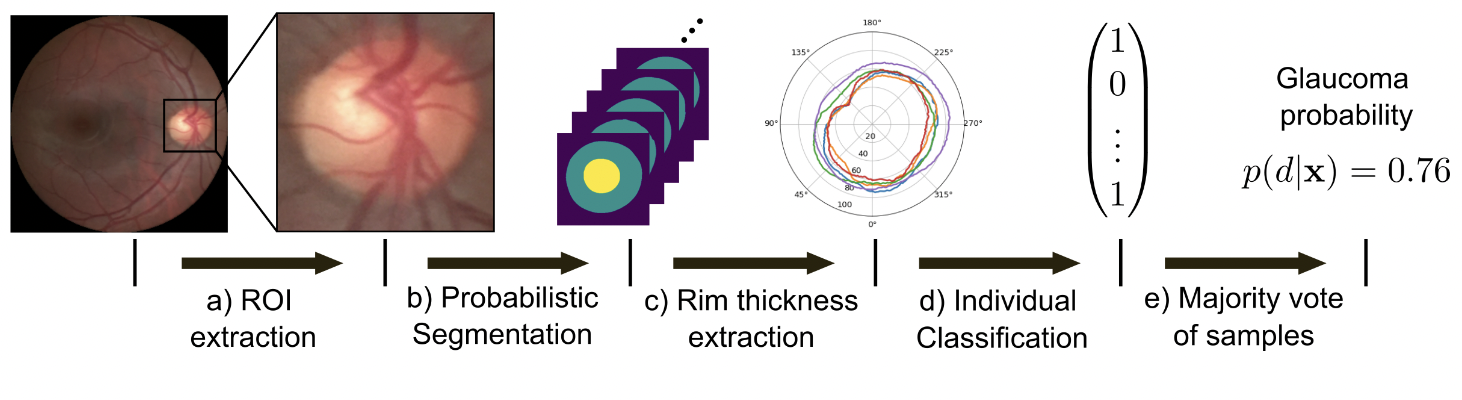 Leveraging probabilistic segmentation models for improved glaucoma diagnosis: A clinical pipeline approach
